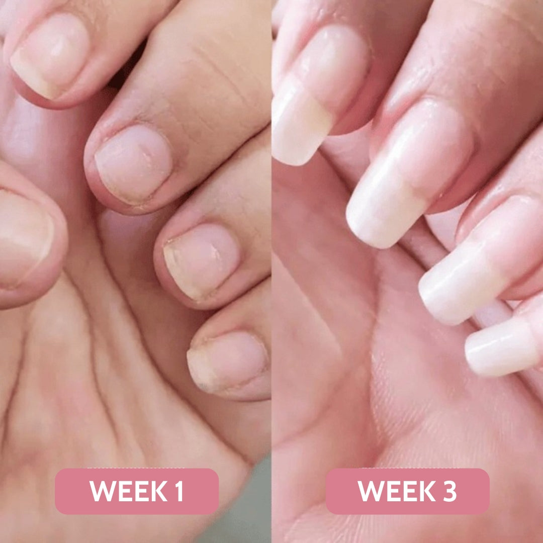 NEVANA ONE™ NAIL GROWTH SERUM + STEM CELLS