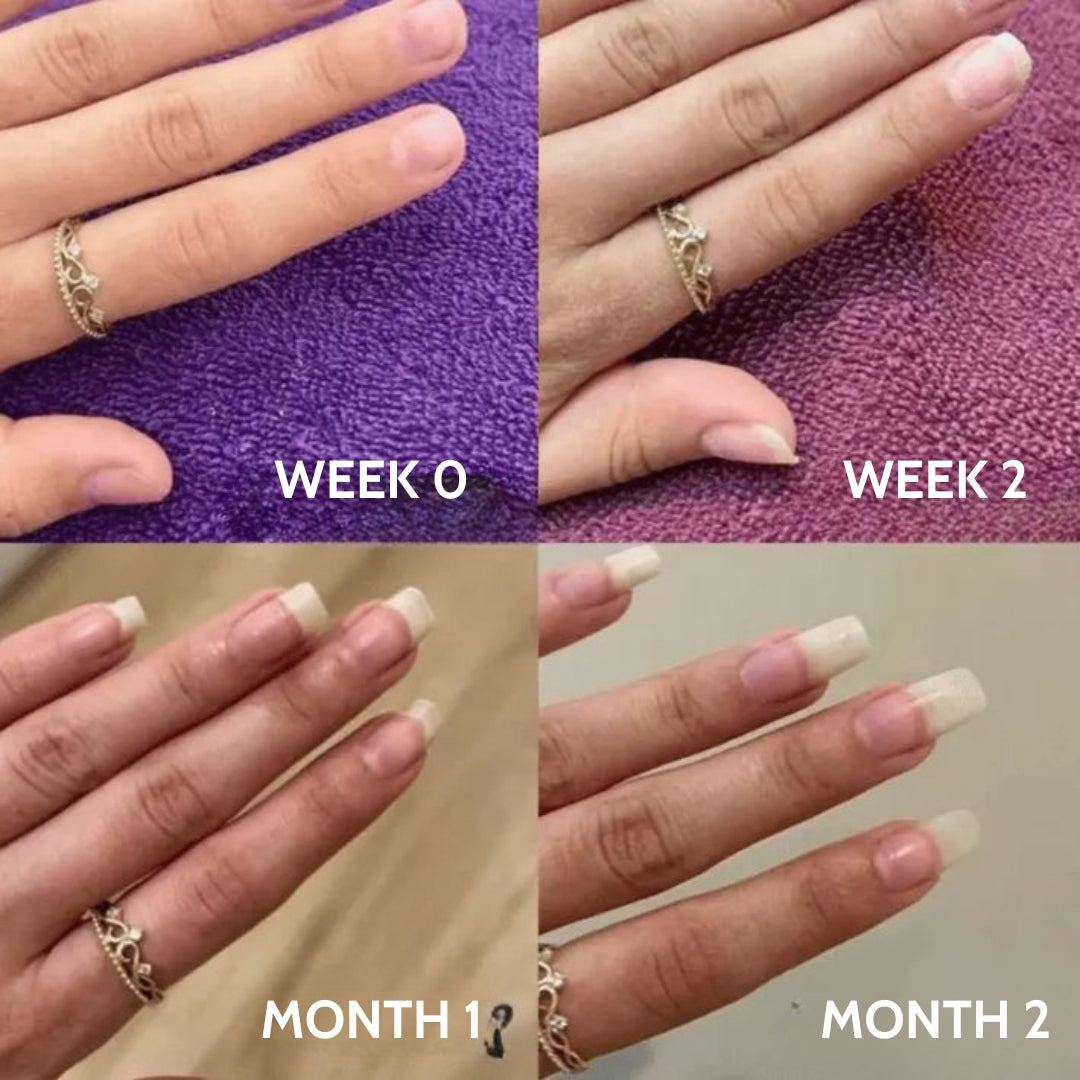 NEVANA ONE™ NAIL GROWTH SERUM + STEM CELLS