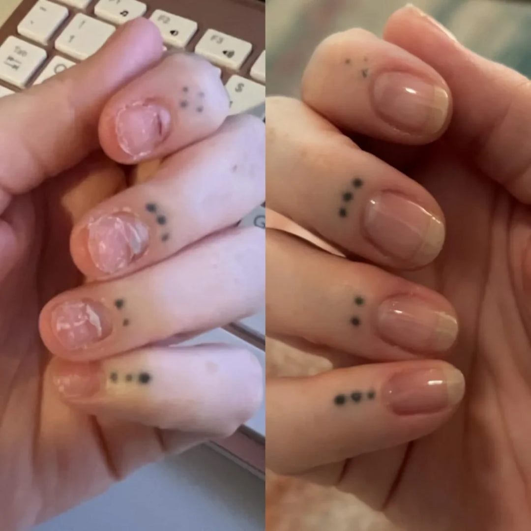 NEVANA ONE™ NAIL GROWTH SERUM + STEM CELLS